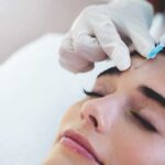 Best Time to Book a Botox Procedure