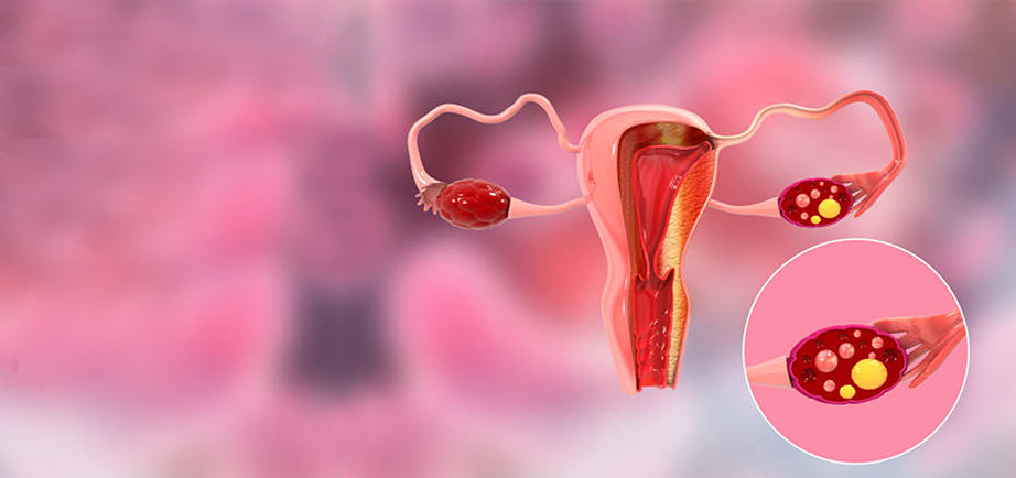 8 Questions to Ask Before Agreeing to Gynaecological Cancer Surgery